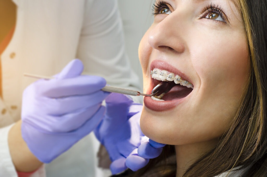 4 Tips for Braces & Invisalign